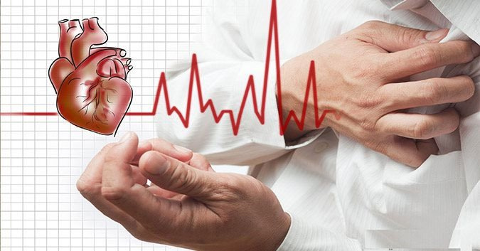 Myocardial infarction là gì