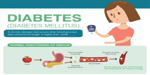 diabetes là gì