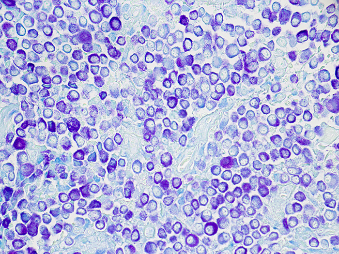 mast cell là gì