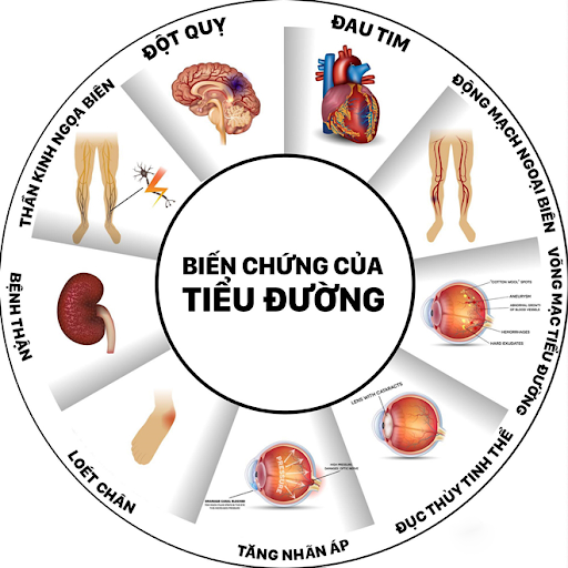 bệnh tiểu đường tiếng anh là gì