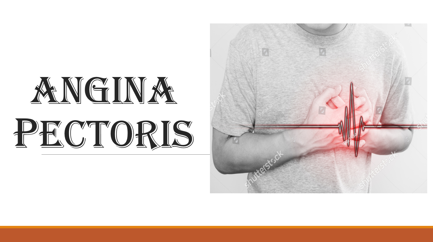 angina pectoris là gì