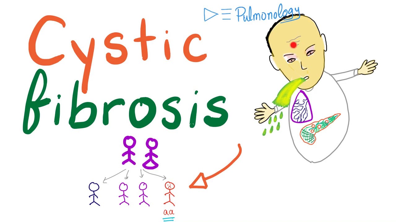 cystic fibrosis là gì