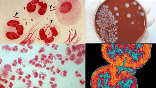 vi khuẩn sinh sản chủ yếu bằng cách nào